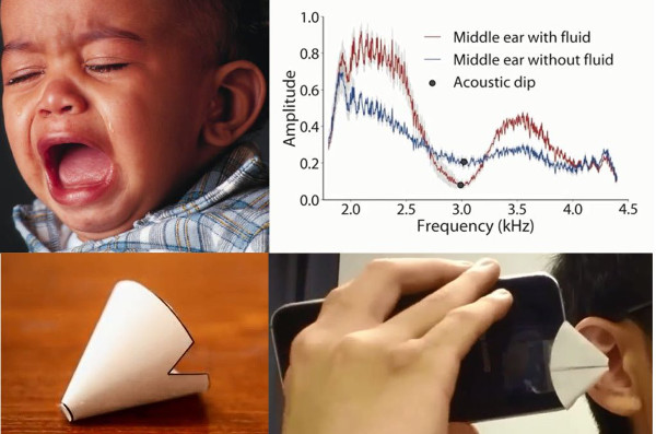 Il tuo telefono potrebbe aiutarti a salvare l'udito del tuo bambino
